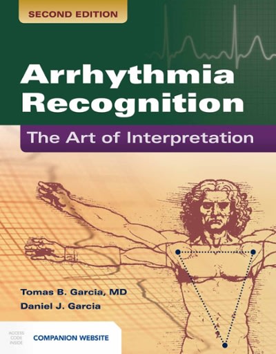 arrhythmia recognition the art of interpretation the art of interpretation 2nd edition tomas b garcia, daniel