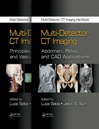 multi detector ct imaging handbook two volume set 1st edition luca saba, jasjit s. suri b00fjlfwe4,