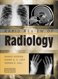 rapid review of radiology 1st edition shahid hussain, sherif aaron abdel latif, adrian david hall