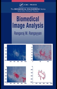 biomedical image analysis 1st edition rangaraj m. rangayyan 0849396956,0203492544