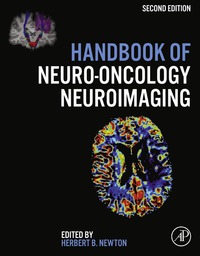 handbook of neuro oncology neuroimaging 2nd edition herbert b. newton 0128009454,0128011688