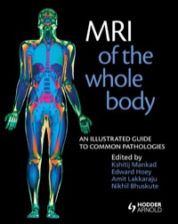 mri of the whole body an illustrated guide for common pathologies 1st edition nikhil bhuskute, edward hoey,
