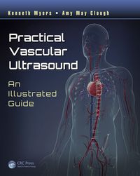 practical vascular ultrasound an illustrated guide 1st edition kenneth myers, amy may clough