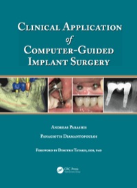 clinical application of computer guided implant surgery 1st edition andreas parashis, panagiotis