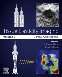 tissue elasticity imaging clinical applications volume 2 1st edition s. kaisar alam, brian s, garra