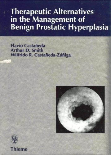 therapeutic alternatives in management of benign prostatic hyperplasia 1st edition arthur d. smith , flavio