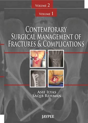 contemporary surgical management of fractures and complications 1st edition m.d. ilyas asif 9350259648,