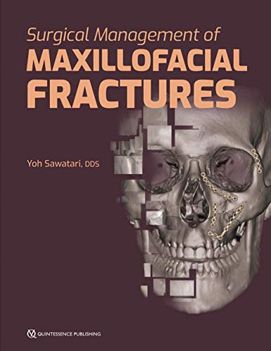 surgical management of maxillofacial fractures 1st edition yoh sawatari 0867157941, 9780867157949