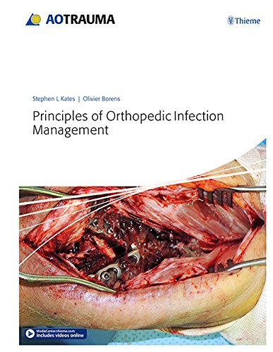 principles of orthopedic infection management 1st edition stephen kates , olivier borens 3132410756,