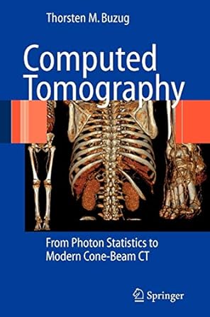 computed tomography from photon statistics to modern cone beam ct 1st edition thorsten m. buzug 3642072577,