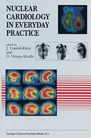 nuclear cardiology in everyday practice 1st edition j. candell-riera ,d. ortega-alcalde 9401048762,