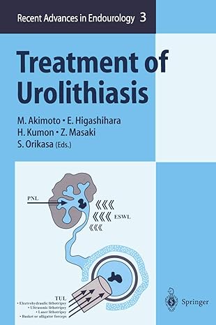 treatment of urolithiasis 1st edition m akimoto ,e higashihara ,h kumon ,z masaki ,s orikasa 4431685197,