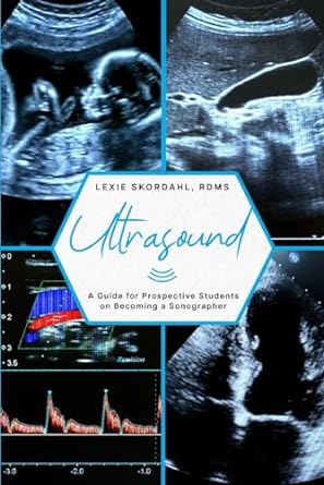 ultrasound a guide for prospective students on becoming a sonographer 1st edition lexie skordahl rdms, rvt