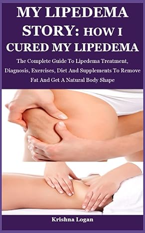 my lipedema story how i cured my lipedema the complete guide to lipedema treatment diagnosis exercises diet
