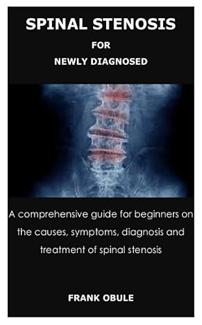 spinal stenosis for newly diagnosed a comprehensive guide for beginners on the causes symptoms diagnosis and