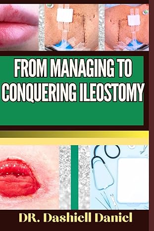 from managing to conquering ileostomy expert guide to understanding the causes recognizing symptoms
