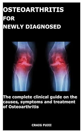 osteoarthritis for newly diagnosed the complete clinical guide on the causes symptoms and treatment of
