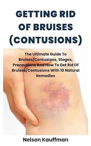 getting rid of bruises the ultimate guide to bruises/contusions stages precautions and how to get rid of