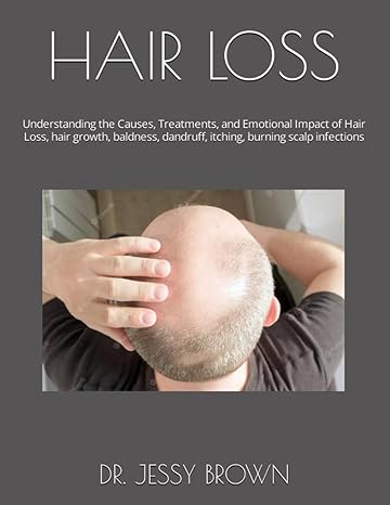 hair loss understanding the causes treatments and emotional impact of hair loss hair growth baldness dandruff
