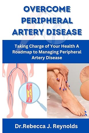 overcome peripheral artery disease taking charge of your health a roadmap to managing peripheral artery