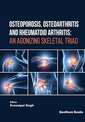 osteoporosis osteoarthritis and rheumatoid arthritis an agonizing skeletal triad 1st edition puneetpal singh
