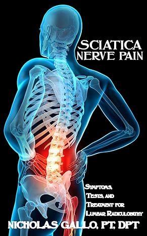 Sciatica Nerve Pain Symptoms Tests And Treatments For Lumbar Radiculopathy