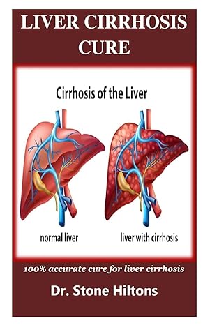 liver cirrhosis cure 100 accurate cure for liver cirrhosis 1st edition dr stone hiltons 1075802458,