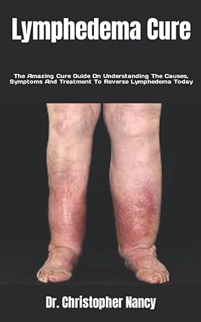 lymphedema cure the amazing cure guide on understanding the causes symptoms and treatment to reverse