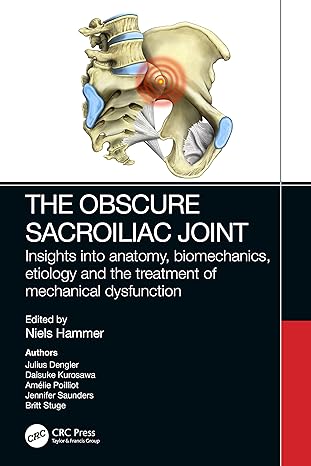 the obscure sacroiliac joint insights into anatomy biomechanics etiology and the treatment of mechanical