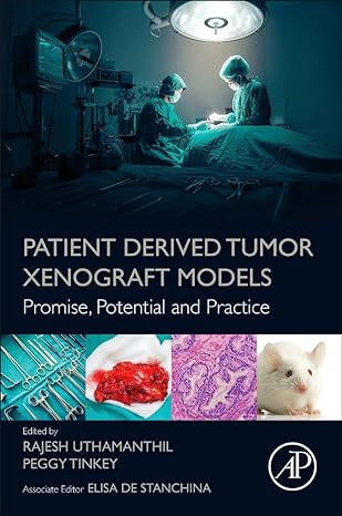 patient derived tumor xenograft models promise potential and practice 1st edition rajesh uthamanthil ,peggy