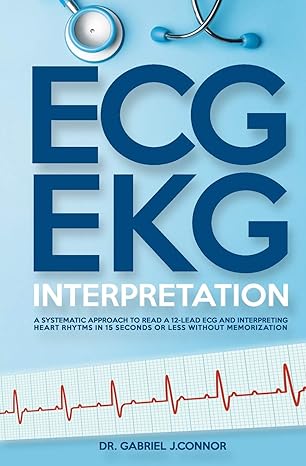 ecg / ekg interpretation a systematic approach to read a 12 lead ecg and interpreting heart rhythms in 15