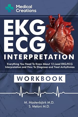 ekg/ecg interpretation everything you need to know about the 12 lead ecg/ekg interpretation and how to