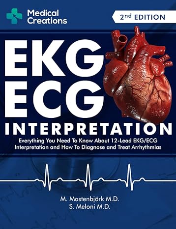 ekg/ecg interpretation everything you need to know about the 12 lead ecg/ekg interpretation and how to