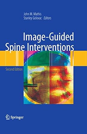 image guided spine interventions 1st edition john m. mathis, stanley golovac 1493938290, 978-1493938292