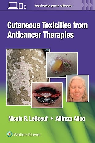 cutaneous toxicities from anticancer therapies 1st edition dr nicole leboeuf ,dr allireza alloo 1975157893,