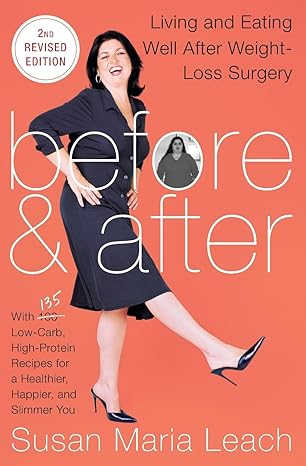 before and after second revised edition living and eating well after weight loss surgery 2nd revised edition