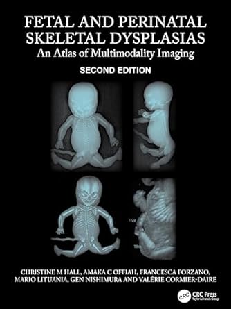 fetal and perinatal skeletal dysplasias an atlas of multimodality imaging 1st edition christine m hall ,amaka