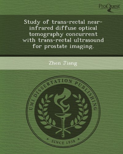 study of trans rectal near infrared diffuse optical tomography concurrent with trans rectal ultrasound for