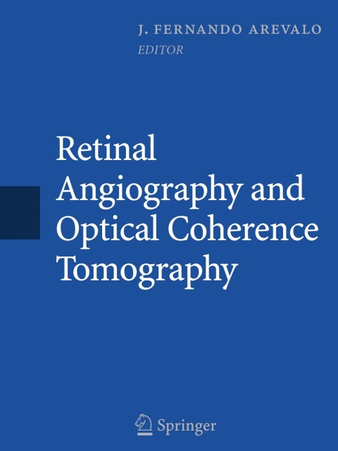 retinal angiography and optical coherence tomography 2009 edition arévalo (ed.), j. fernando 0387689877,