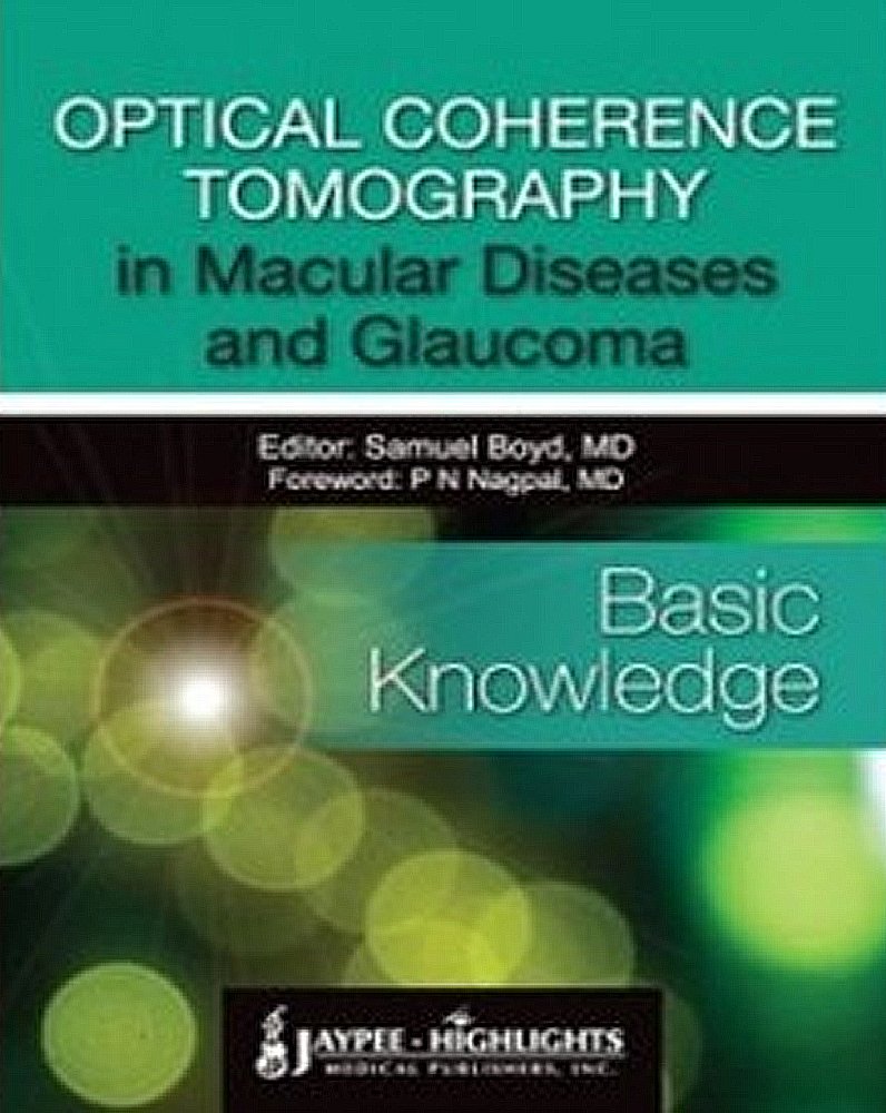 optical coherence tomography in macular diseases and glaucoma basic knowledge 2011 (1e) edition samuel boyd,