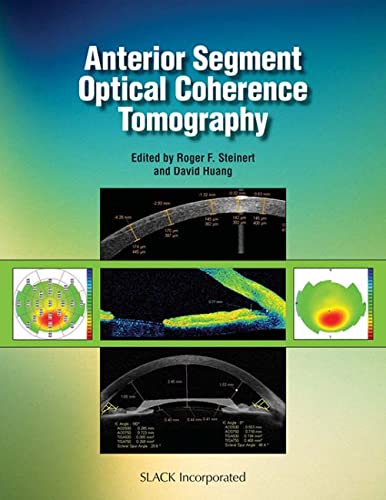 anterior segment optical coherence tomography 1st edition steinert md, roger, huang md  phd, david