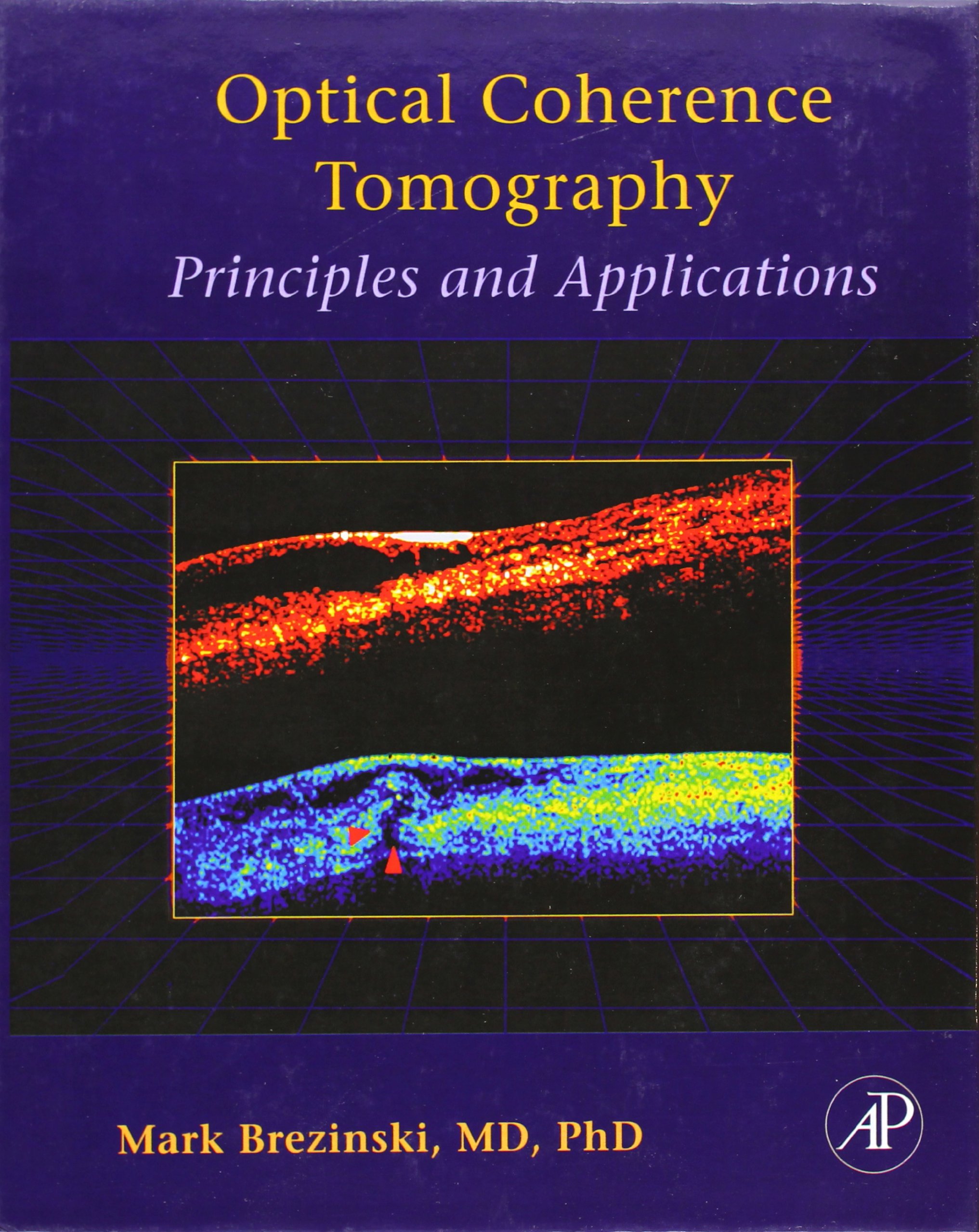 optical coherence tomography principles and applications 1st edition brezinski, mark e. 0121335704,