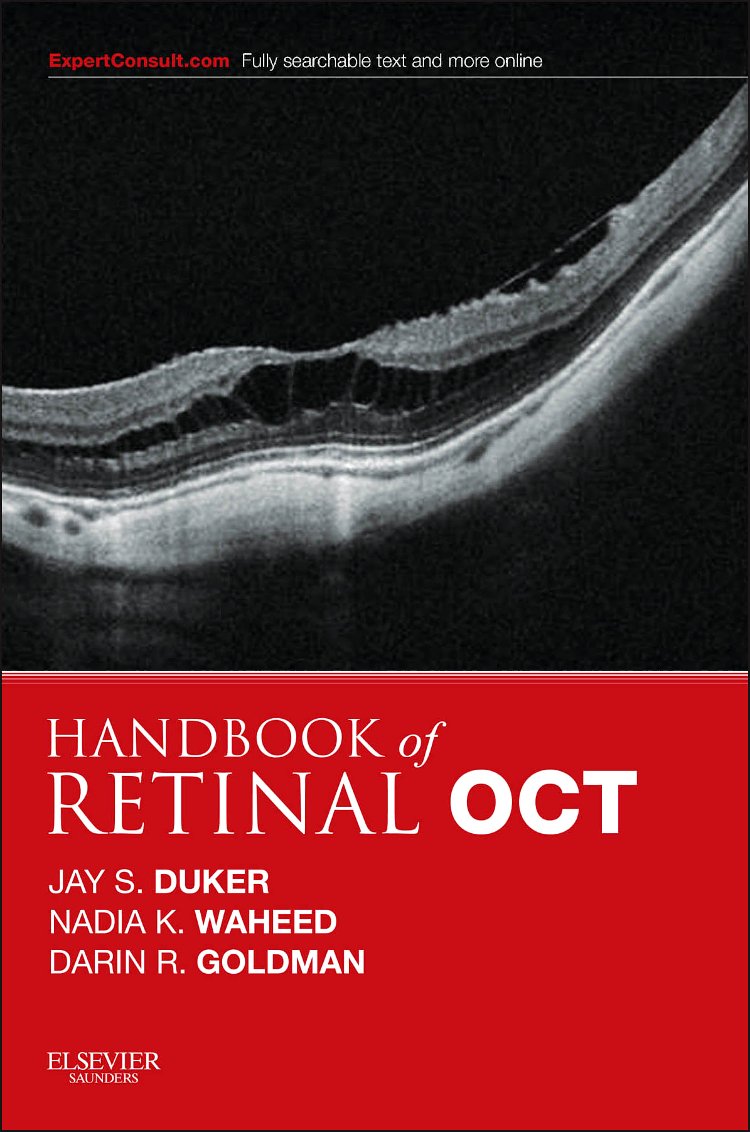 handbook of retinal oct optical coherence tomography 1st edition duker, jay s., waheed, nadia k, goldman,
