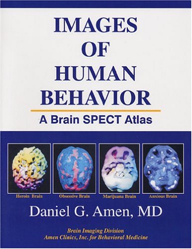 images of human behavior a brain spect atlas  amen, daniel g. 1886554048, 9781886554047
