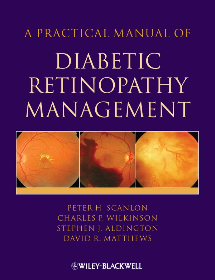 a practical manual of diabetic retinopathy management 1st edition scanlon, peter h., aldington, stephen,