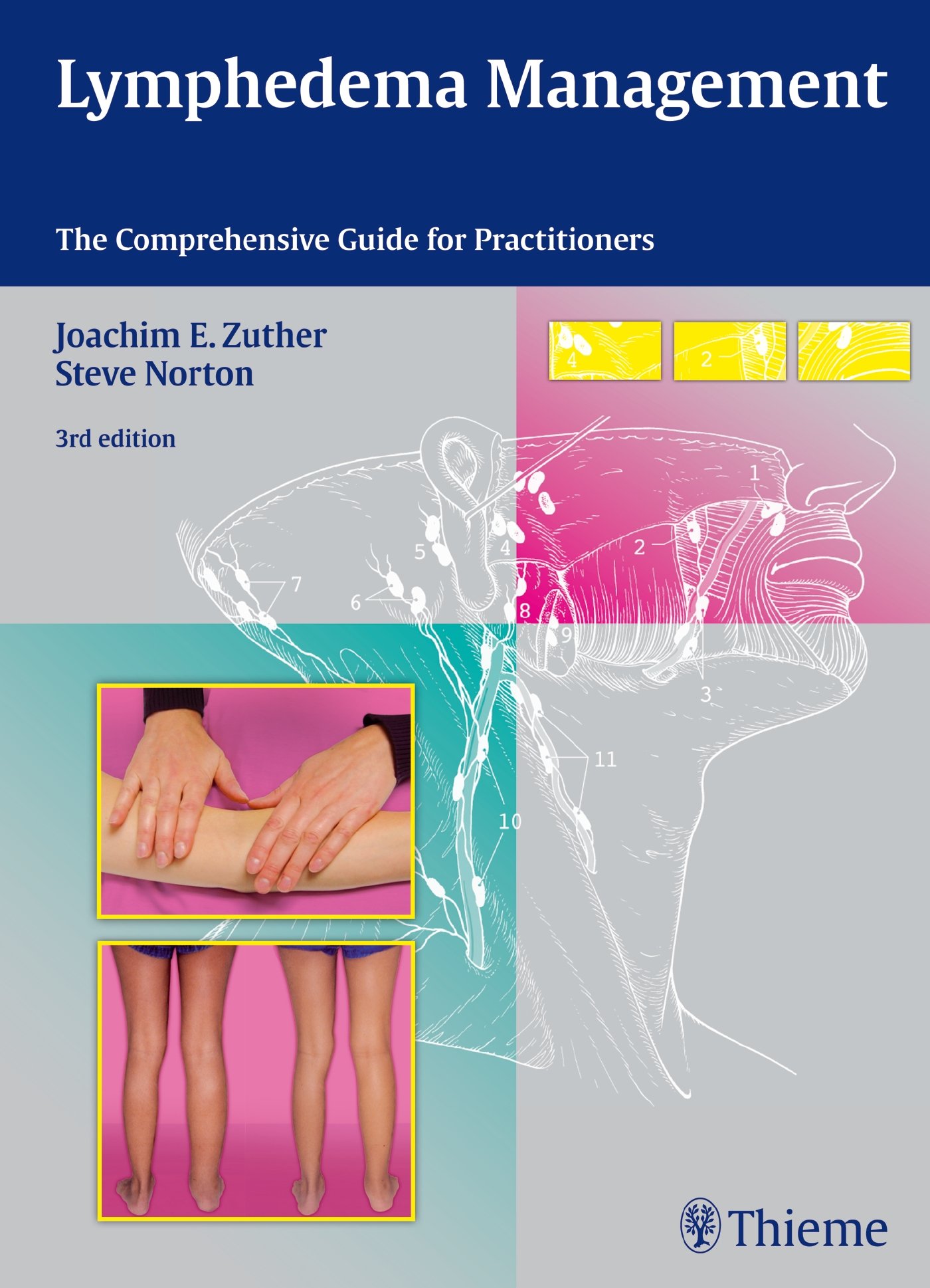 lymphedema management the comprehensive guide for practitioners 3rd edition zuther, joachim ernst, norton,