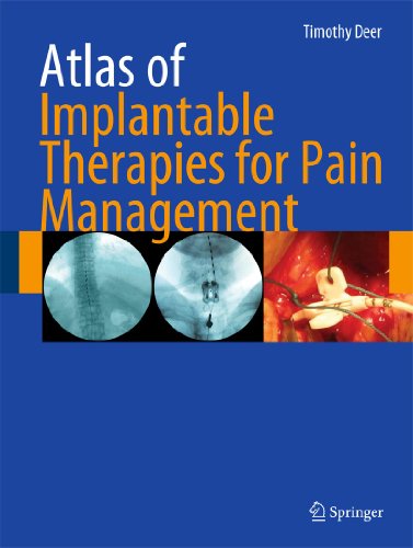 atlas of implantable therapies for pain management 1st edition timothy r. deer 0387885668, 9780387885667