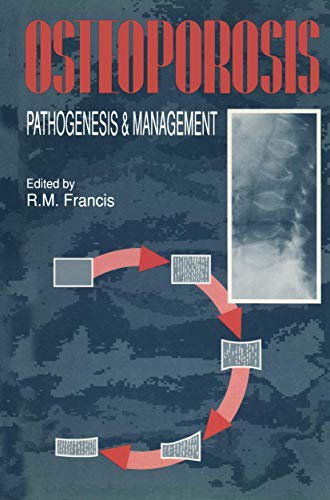osteoporosis pathogenesis and management 1990 edition francis, r. m. (roger michael) 0792389336, 9780792389330