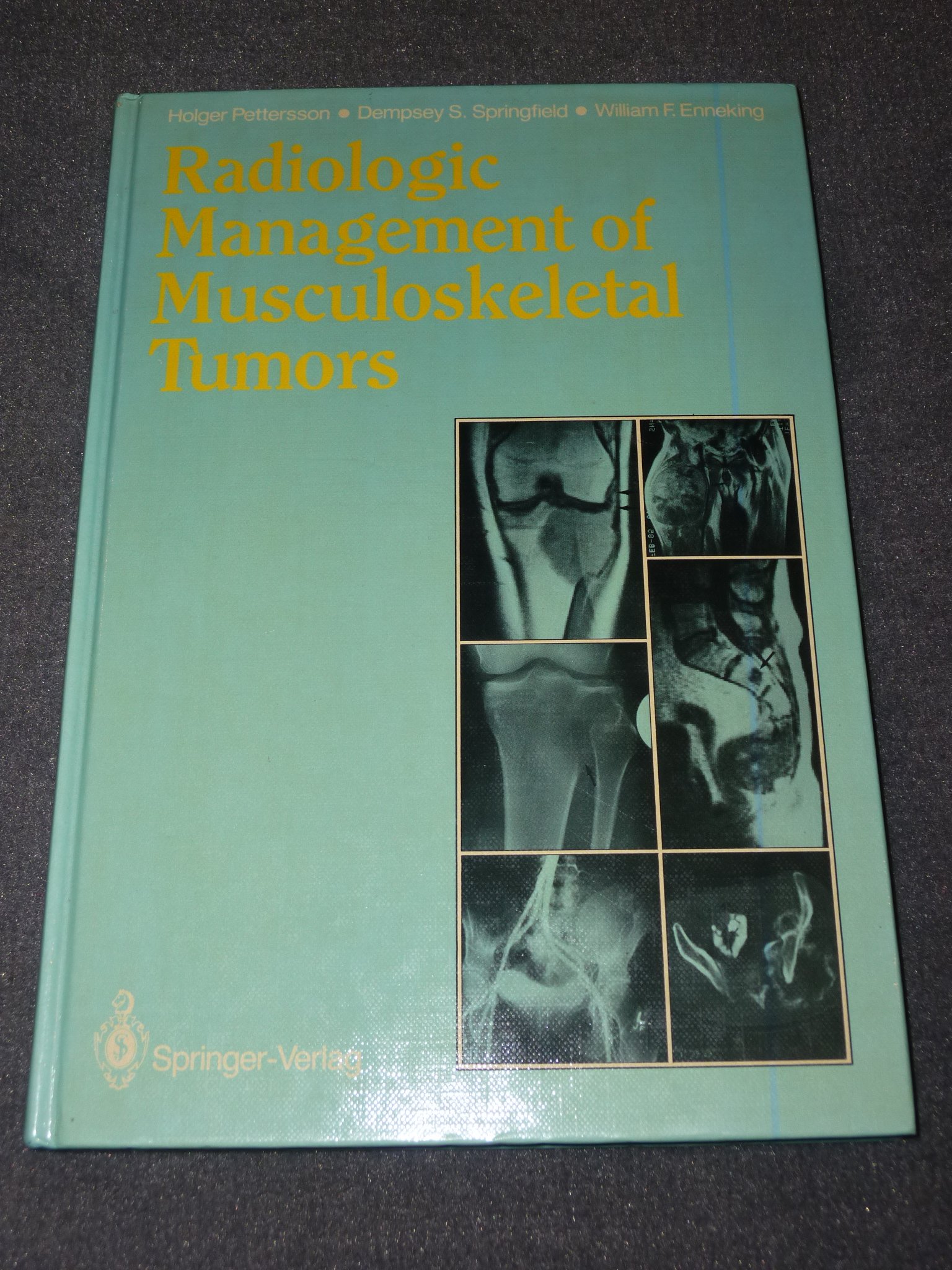 radiologic management of musculoskeletal tumors 1st edition pettersson, holger, springfield, dempsey s.,