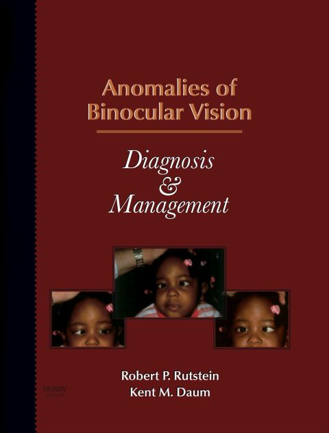 anomalies of binocular vision diagnosis and management 1st edition rutstein od  ms, robert p., daum od  ms 